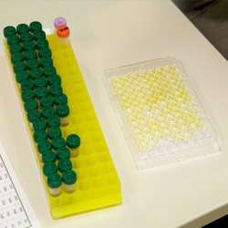 Coiled coil domain containing protein 41(CCDC41) ELISA kit | Technique alternative | 01014462965