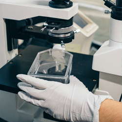Mouse Anti-Human Type II Collagen IgG Antibody Assay Kit, OPD